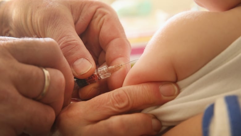 Особенности вакцины против паротита