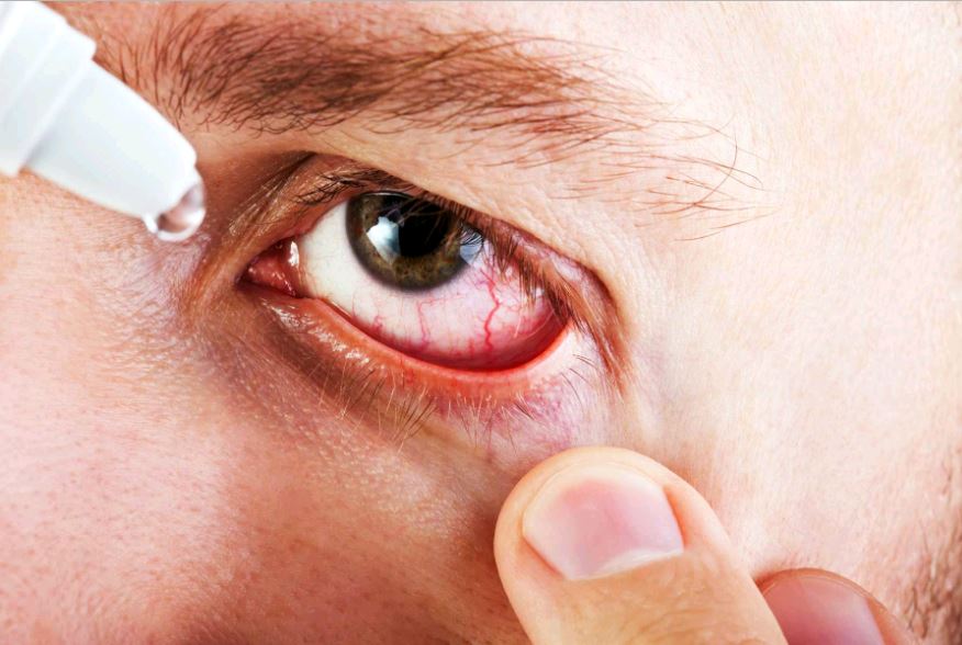 лечение красных глаз 