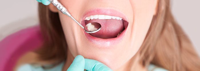 Зачем лечить кариес, ведь дырявые зубы это так красиво