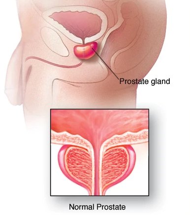 Androgin Prostatitis Vélemények